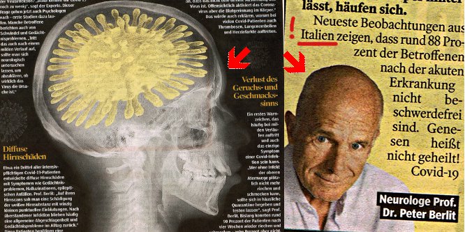 Bild: Neurologe Peter und ein comedyhaftes Virus-Hirn